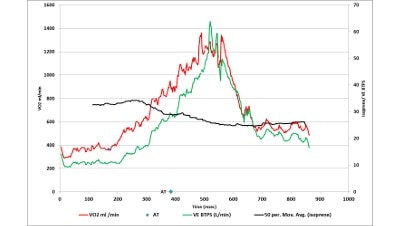Pioneering Metabolism Studies through VOC Analysis: A Glimpse into Hiden Analytical’s Novel Approach