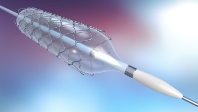 Revolutionising Cardiovascular Health: Monitoring the Surface Metallurgy of Stents
